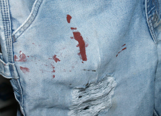 Eine effektive Definitiv Aufklärung blood on jeans Flasche Dauerhaft Rede