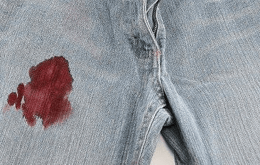 How to Get Blood Out of Your Jeans : 5 Simple Steps