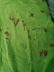 blood stain removal fabric